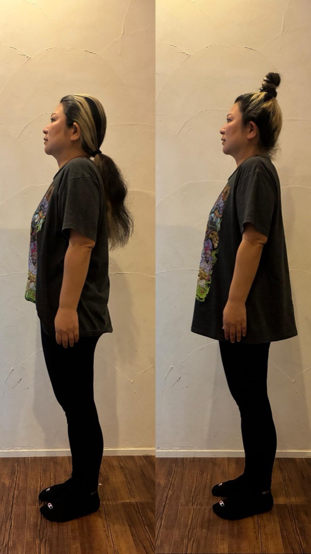 Before After 施術実績