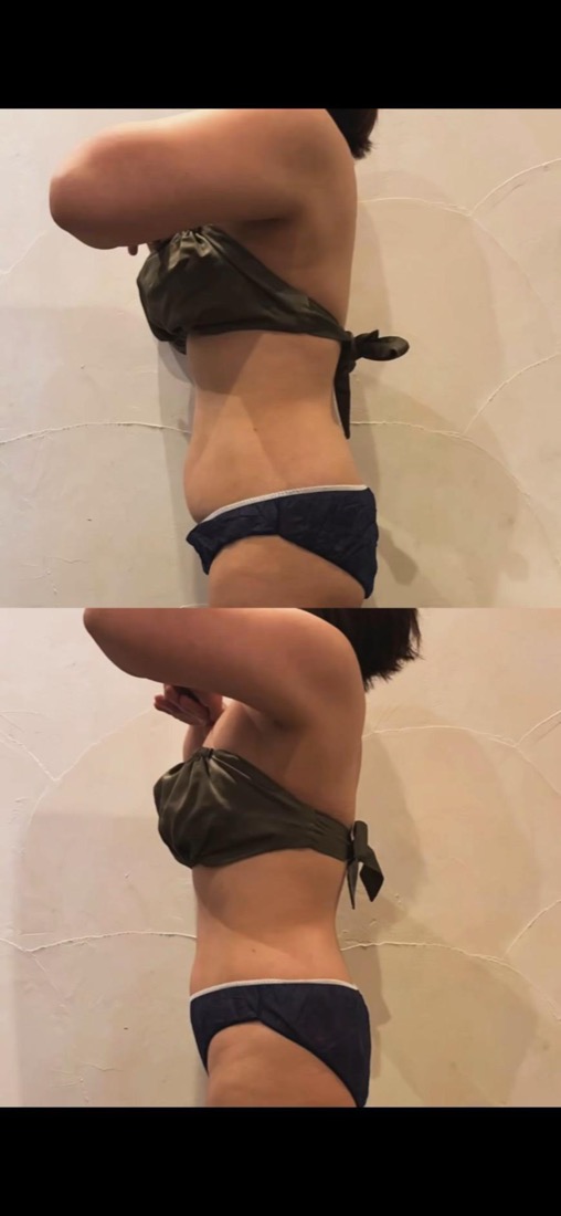 Before After 施術実績