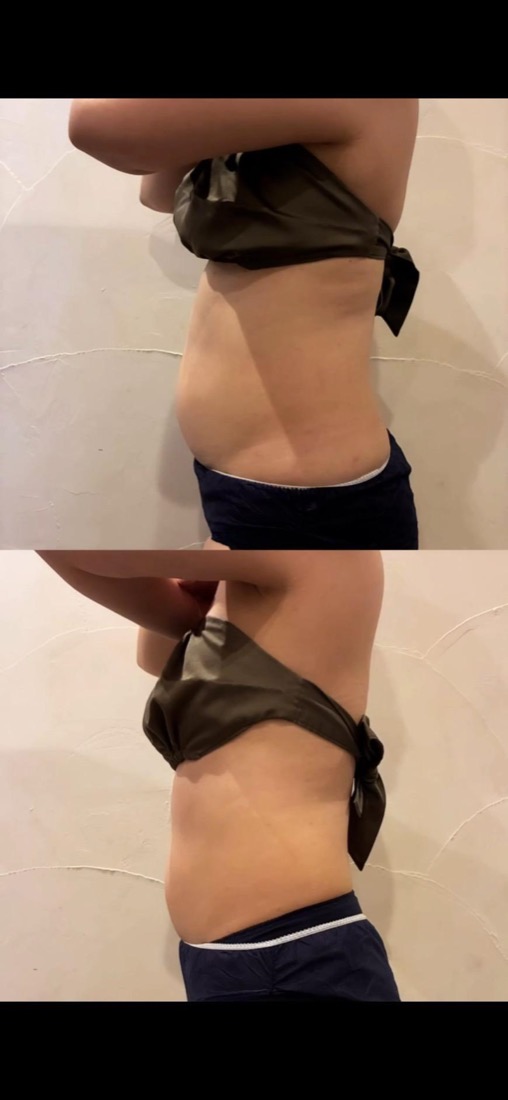 Before After 施術実績