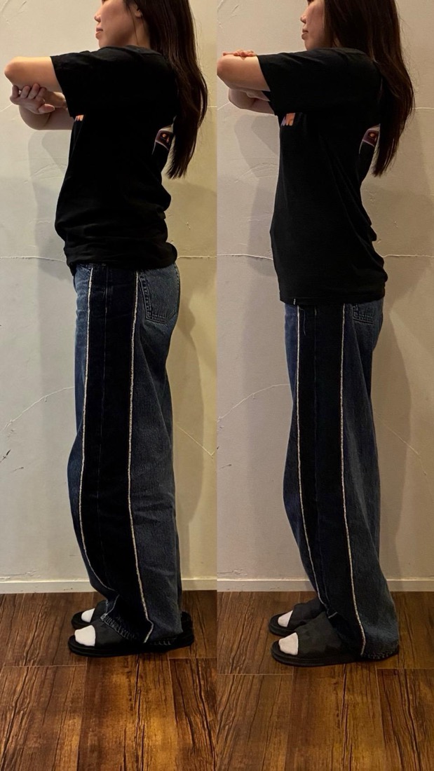 Before After 施術実績