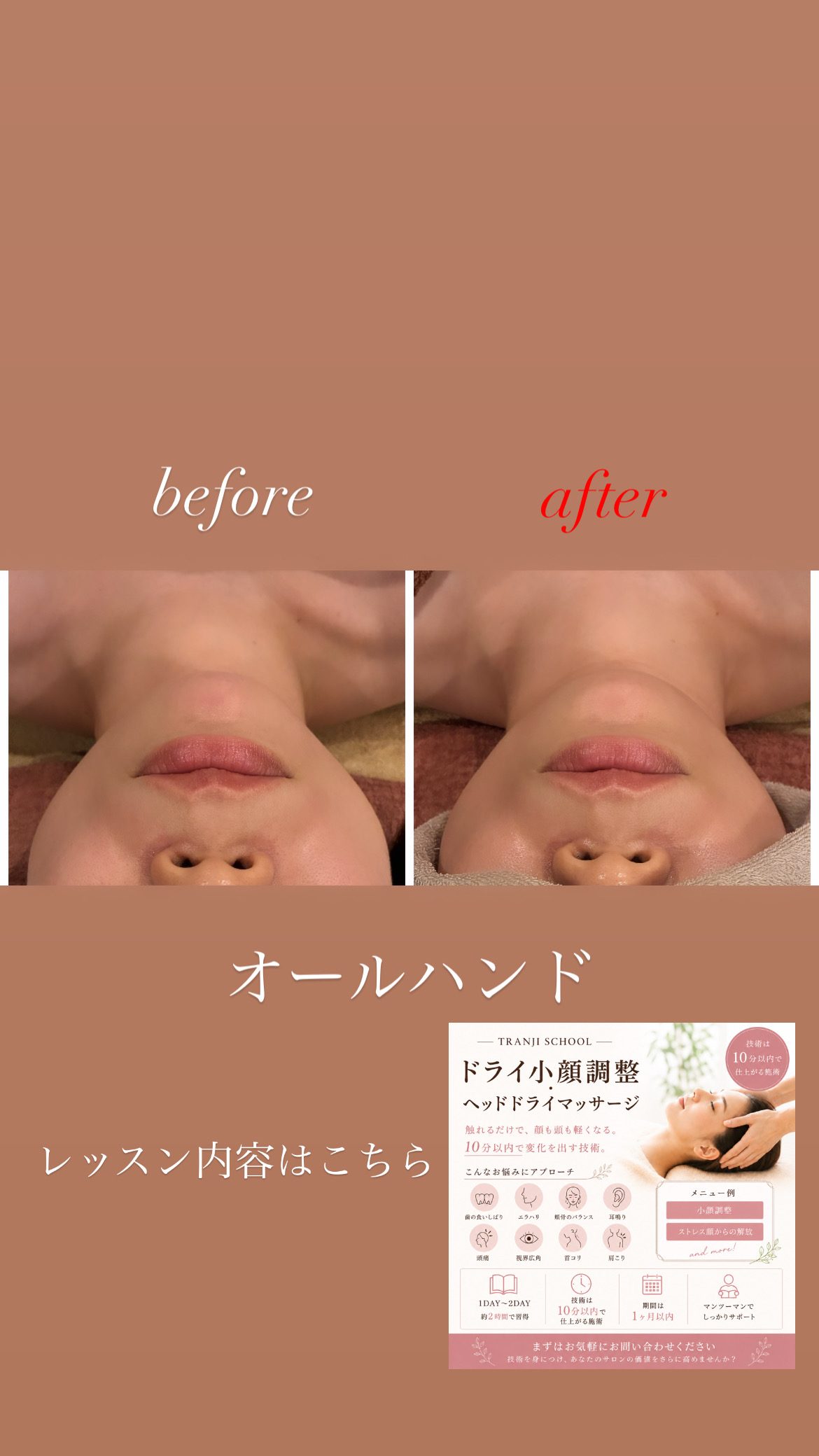 Before After 施術実績